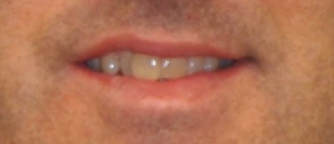 Before